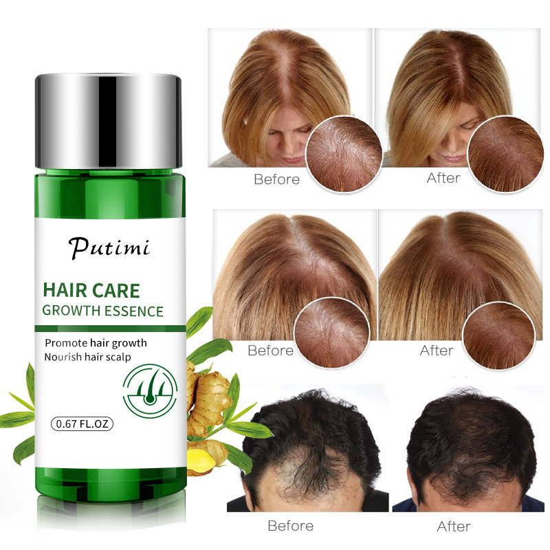 Hair Growth Essential Oil Promoting Hair Growth Prevent Baldness Scalp Anti Hair Loss for Men Women