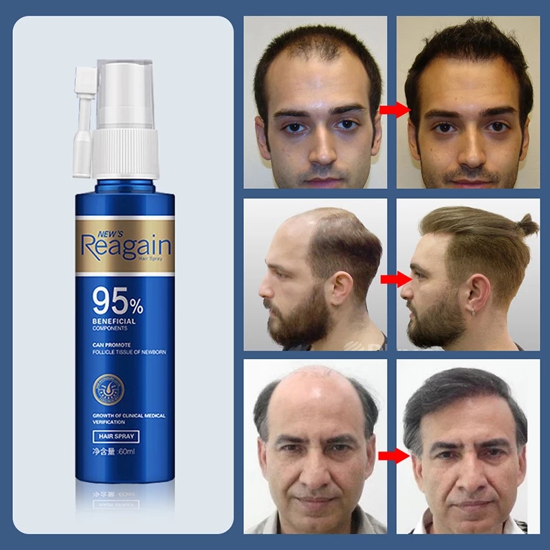 Hair Growth Essence Oil Anti Hair Loss Treatment Growth Oil Repair Hair Roots Hair Care Products