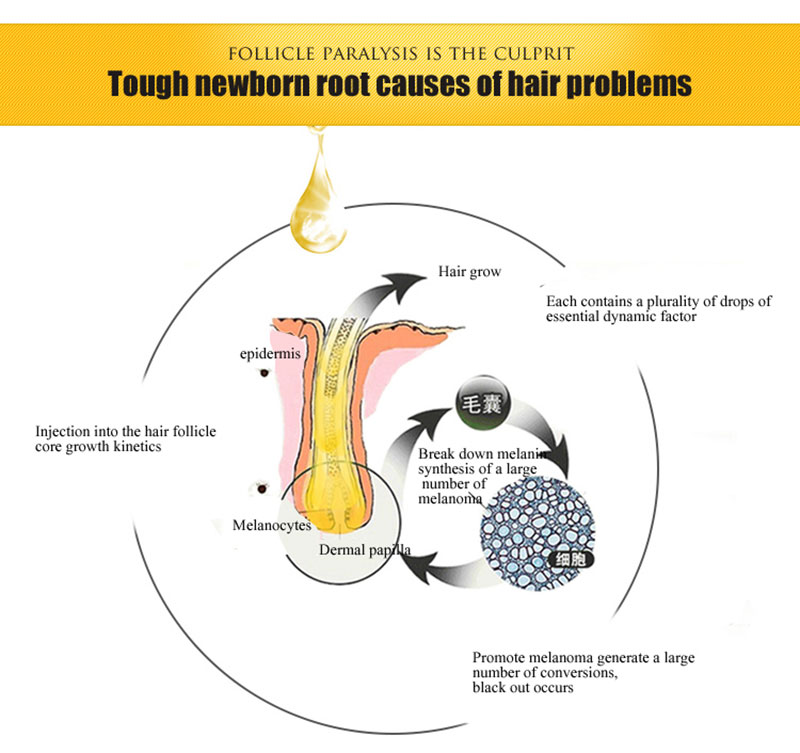 Hair Growth Serum Oil Herbal Keratin Fast Hair Growth Liquid Ginger Sunburst Yuda Pilatory Oil