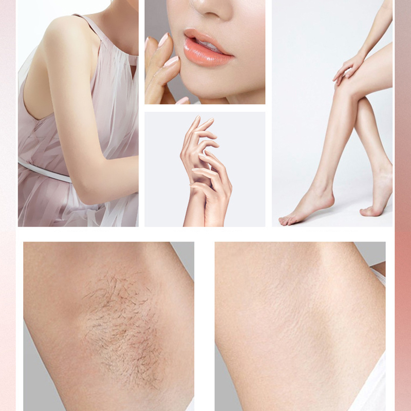 Professional Laser Hair Removal Machine 990000 Flashes Portable For Women Pulsed Light Permanen