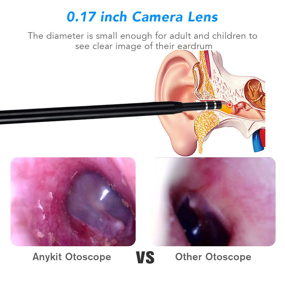 3 in 1 USB Ear Cleaning Endoscope HD Visual Ear Spoon With Mini Camera 5.5mm