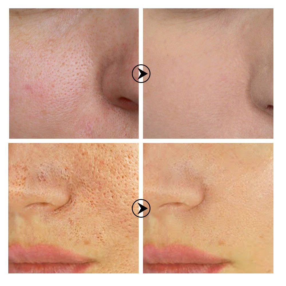 BREYLEE PORE REFINING SERUM Pore Essence Step 2 Step 2 17ml