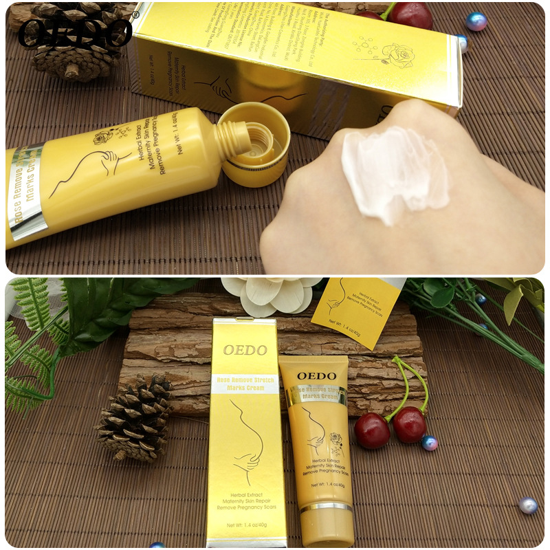 OEDO Rose Cream for Stretch Marks New Style Removal of Stretch Marks Beauty New Style