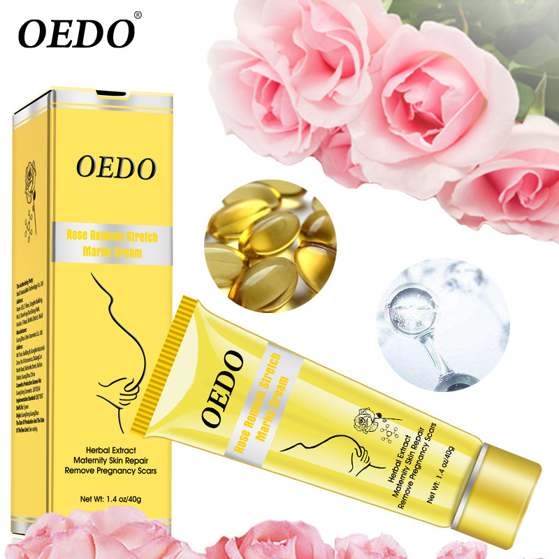 OEDO Rose Cream for Stretch Marks New Style Removal of Stretch Marks Beauty New Style