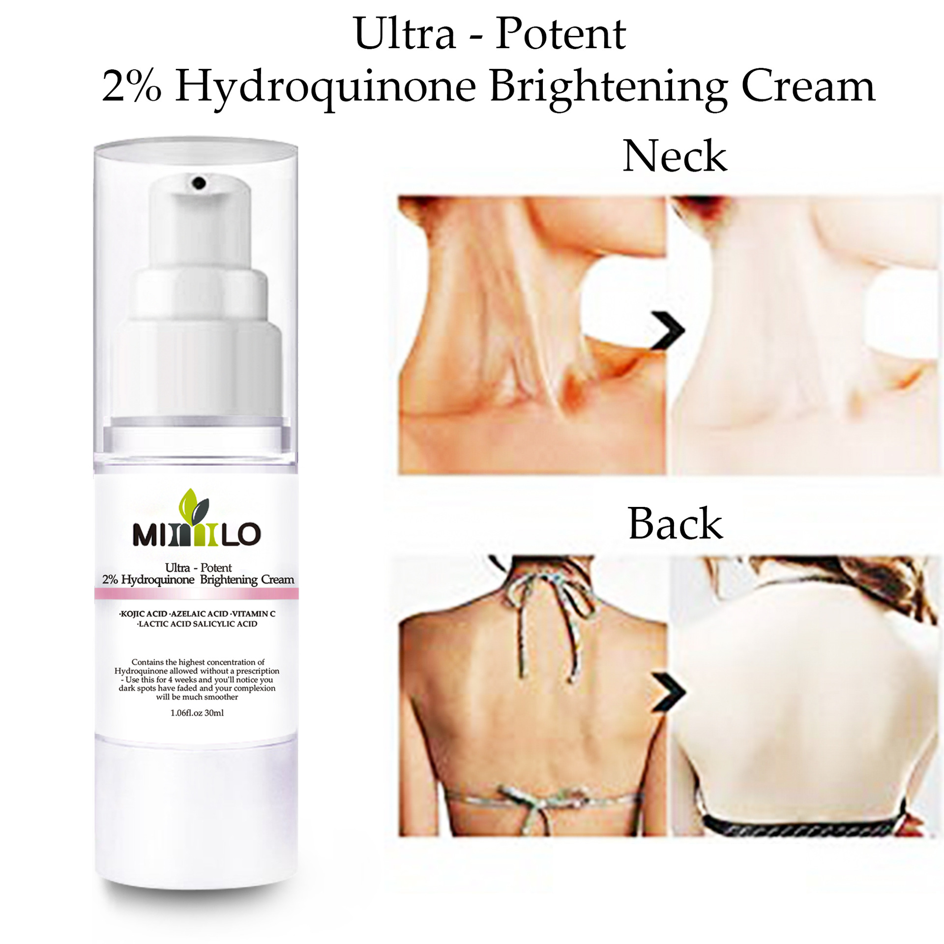New fashion moisturizing hydrating cream brightening cream hydroquinone cream moisturizing hydrating