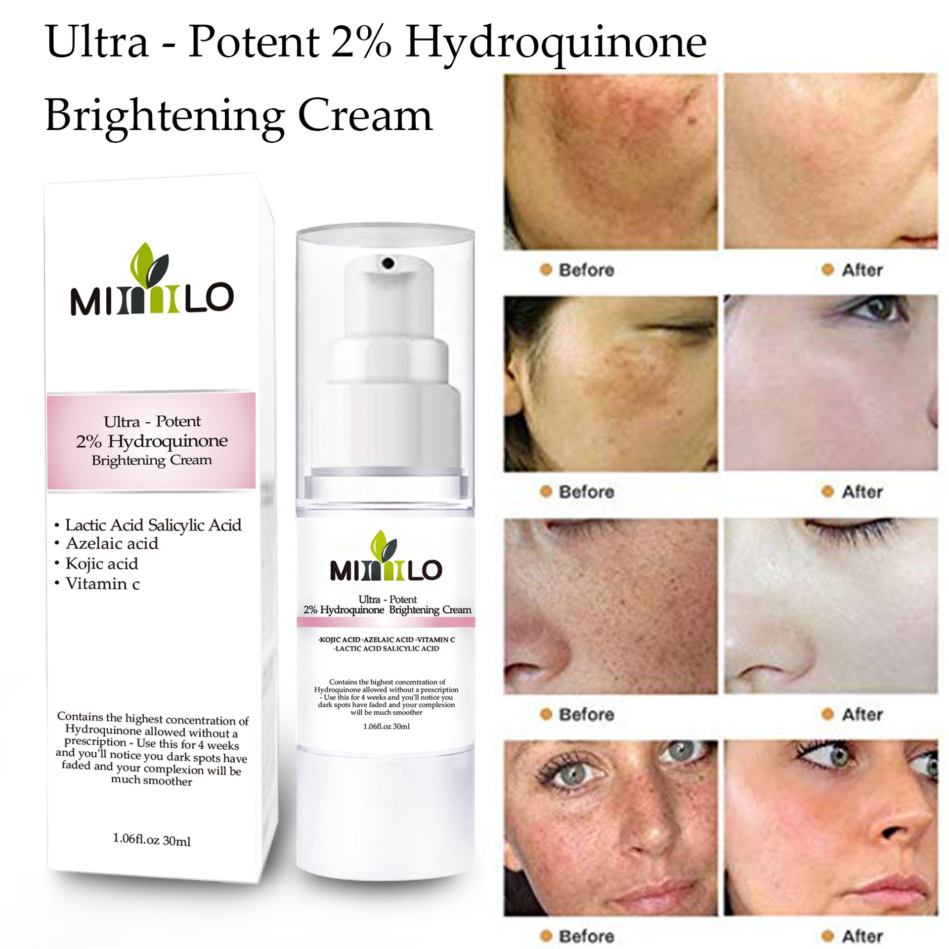 New fashion moisturizing hydrating cream brightening cream hydroquinone cream moisturizing hydrating
