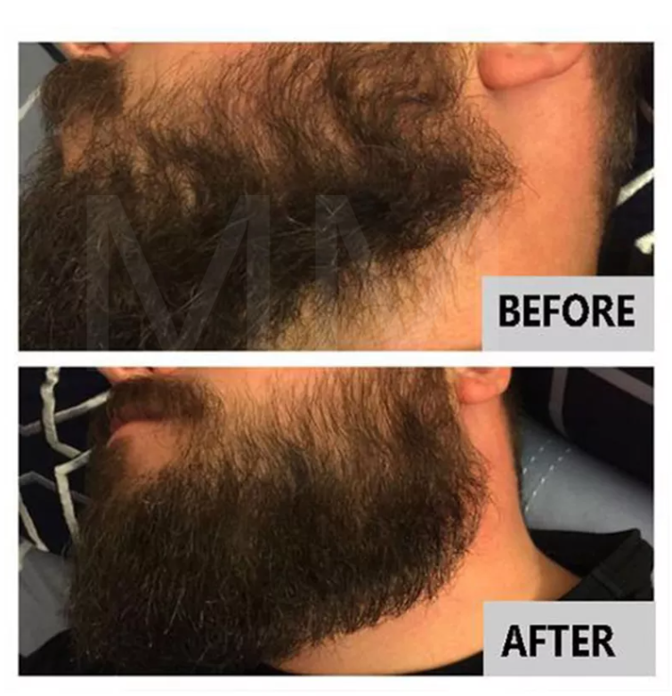 Hot Selling MM Brand New Beard Growth & Fast Hair Growth Oil Hairy Face, Mustache - Softens Strengthens clear sports Cologne perfume