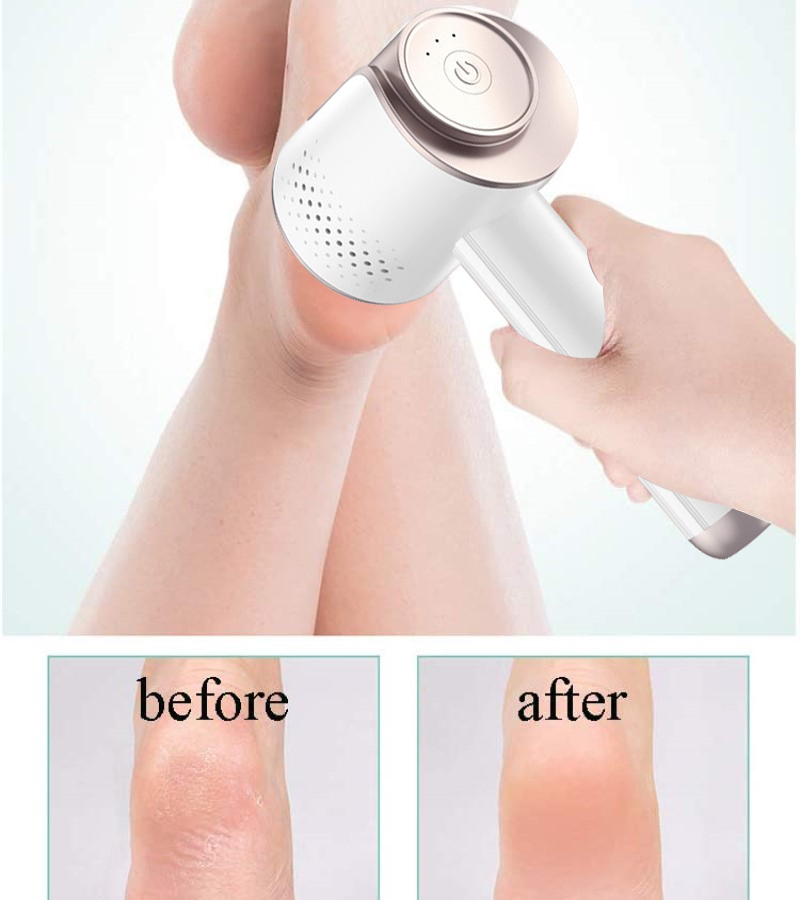 Electric Foot File Callus Remover Foot Grinder Professional USB Rechargeable Pedicure Tools Waterproof,For Remove Calluses