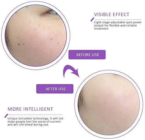 Freckle Remover Machine Mini Laser Plasma Pen Mole Removal Dark Spot Remover Skin Wart Tag Tattoo Remaval Tool Beauty