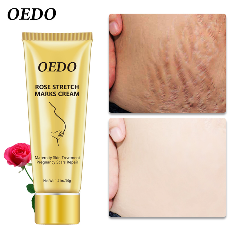 Remove Pregnancy Scars Treatment Body Skin Care Remove Stretch Marks Cream Anti Wrinkle Anti Aging Maternity Skin Repair