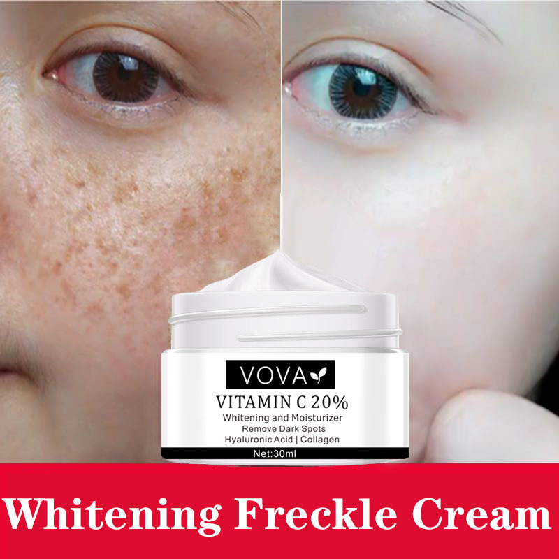 Brighten Pigment Moisturizing Whitening Skin Care Vitamin C Freckle Cream Remove Melanin Color Patch Plaque Spots Removal