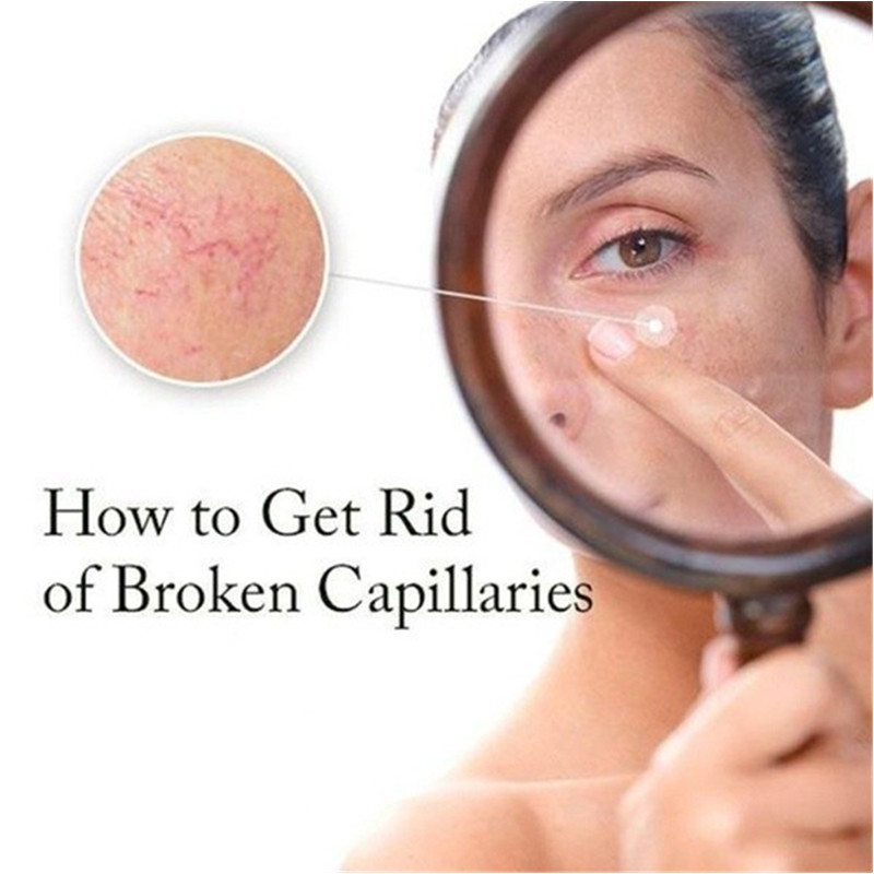 Moisturizing Whitening Cream Facial Care Products Bubble Mask Acne Treatment Remove Blackheads Anti-Redness Soothing