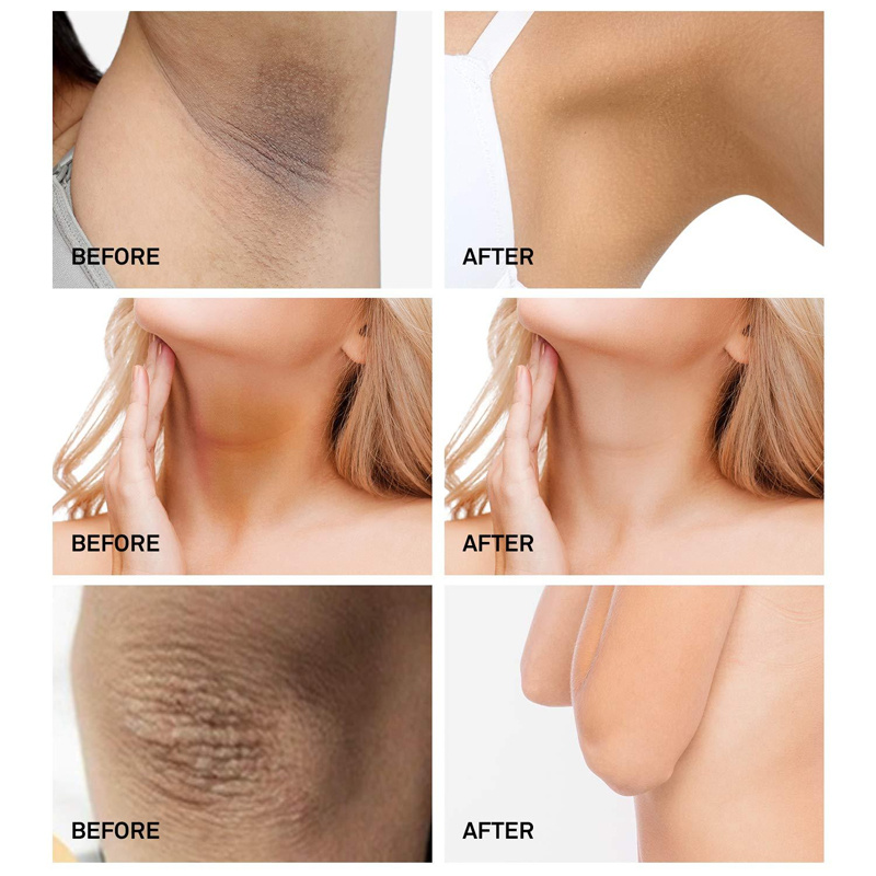 Body Whitening Cream Underarm Armpit Knee Dark Skin Whitening Bleaching Cream Moisturizing Brighten Body Lotion For Women Men