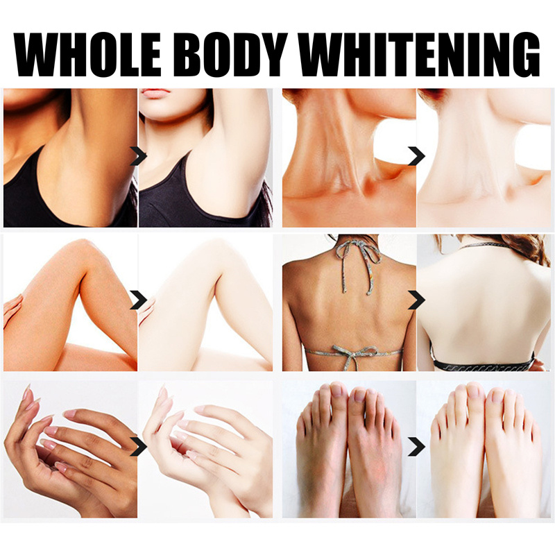 Body Whitening Cream Underarm Armpit Knee Dark Skin Whitening Bleaching Cream Moisturizing Brighten Body Lotion For Women Men