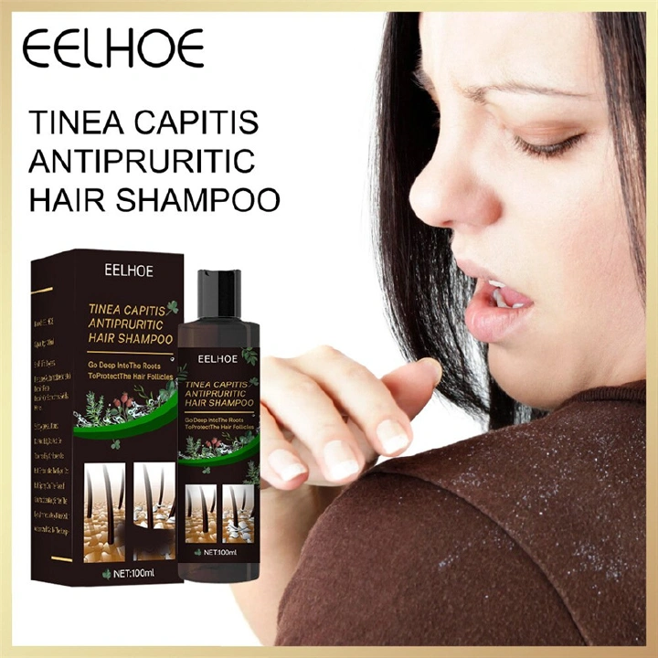 EELHOE Anti-Dandruff Treatment Itching Shampoo Control Oil Anti-off Refreshing Cleansing Shampoo Flaking Scalp Hair Psoriasis