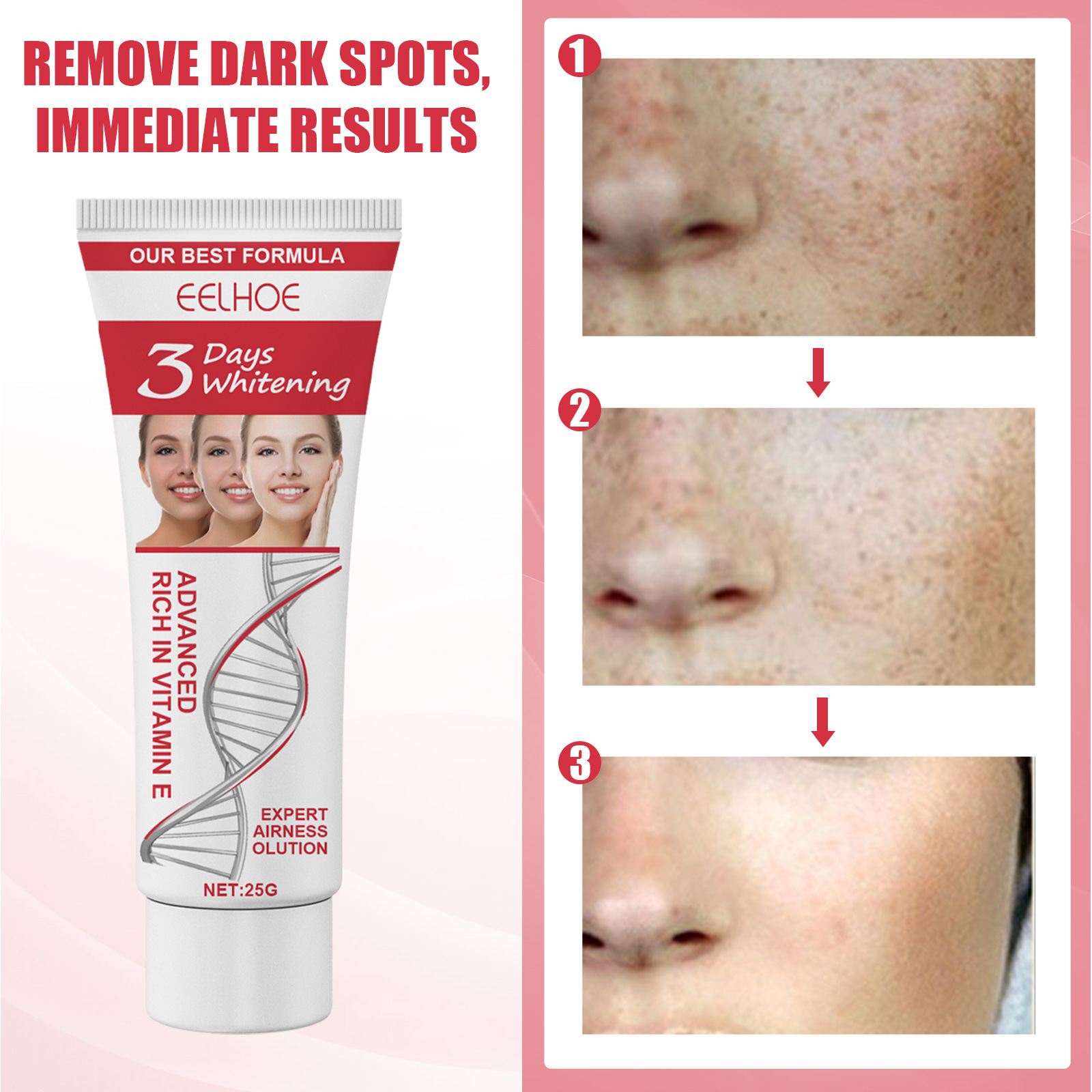 3 Days Kojic Acid Whitening Moisturizing Cream Firming Lifting Face Dilute Spots Anti-Aging Anti-Wrinkle Brightening Skin Care