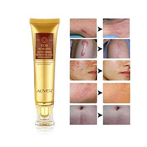 Best Price For Tcm Scar And Acne Mark Removal Gel Cream