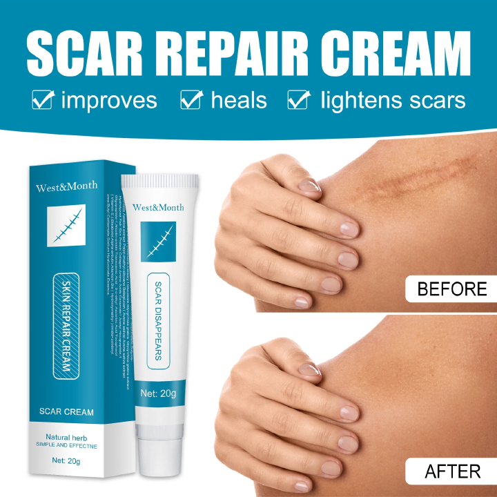 Herbal Scar Removal Cream Gel Stretch Marks Remove Acne Spots Burn Surgical Scars Treatment Smooth Whitening Face Body Skin Care