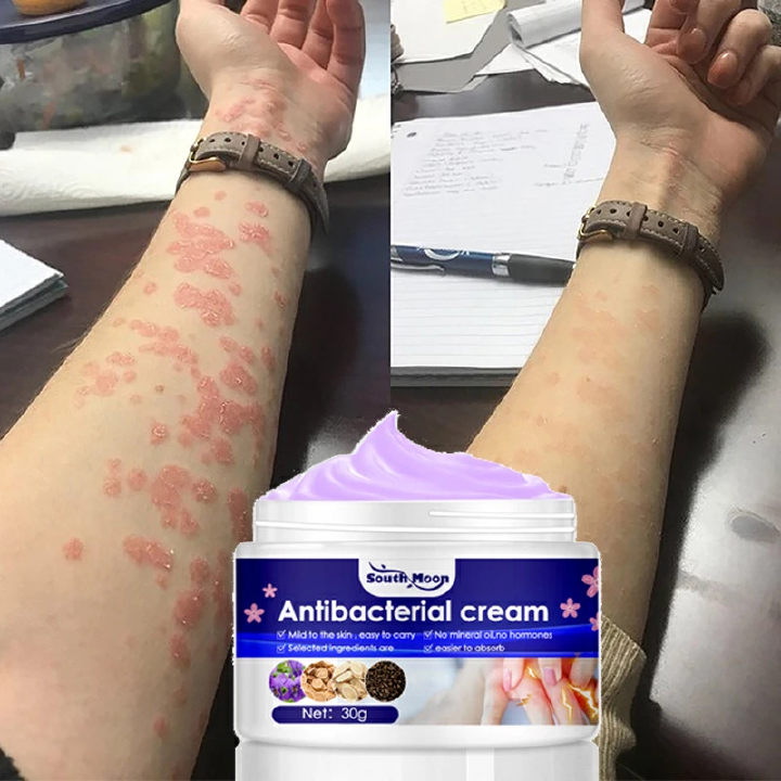 Psoriasis Antibacterial Cream Dermatitis Eczematoid Ointment Effective Anti-Itch Chinese Herb Medical Health Skin Care Products