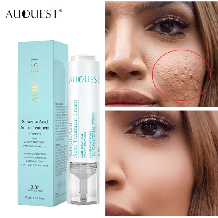 AUQUEST Salicylic Acid Acne Face Cream Oil Contro Whitening Facial Treatment Hyaluronic Black Dots Remove Shrink Pores Skin C