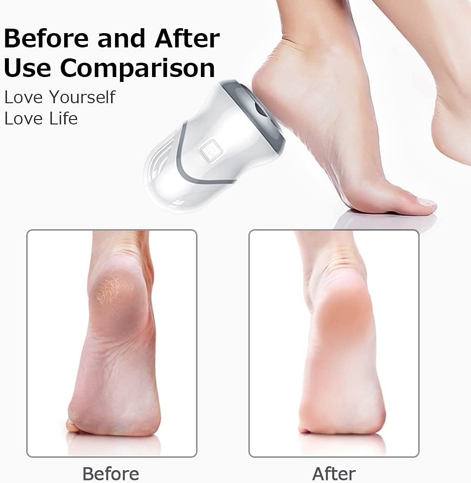 Portable Electric Vacuum Adsorption Foot Grinder Electronic Foot File Pedicure Tools Callus Remover Feet Care Sander
