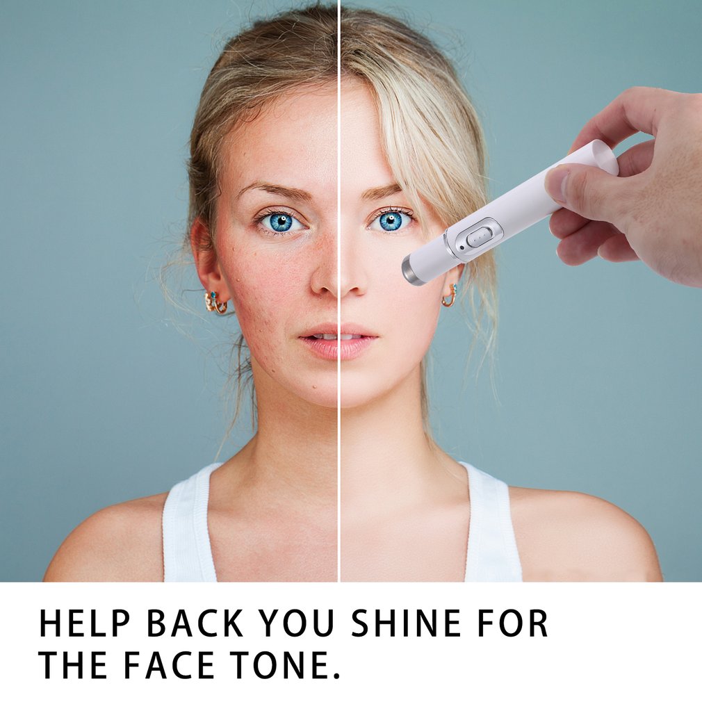 Acne Laser Pen Portable Wrinkle Removal Machine Soft Scar Remover Blue Therapy Massage Spider Vein Eraser Skin Care Beauty Tools