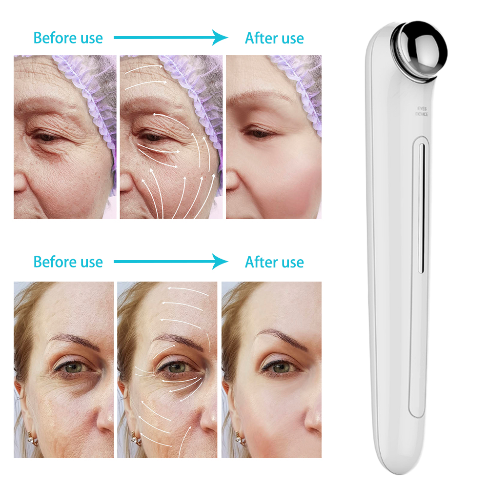 Fashion Eye Skin Care Instrument Massage Stick Remove Dark Circle White ABS Massager Anti Wrinkle Beauty Lip Beauty