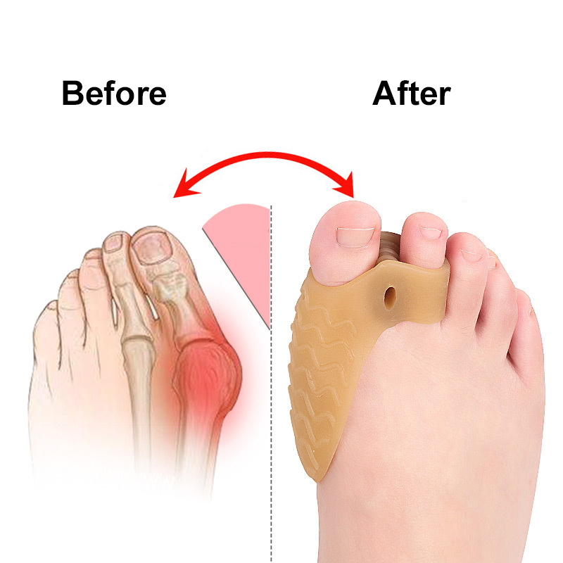 Pexmen 2Pcs/Pair Soft Gel Bunion Corrector Toe Separators Hallux Valgus Bunion Pads Splint for Overlapping Toes Straighter