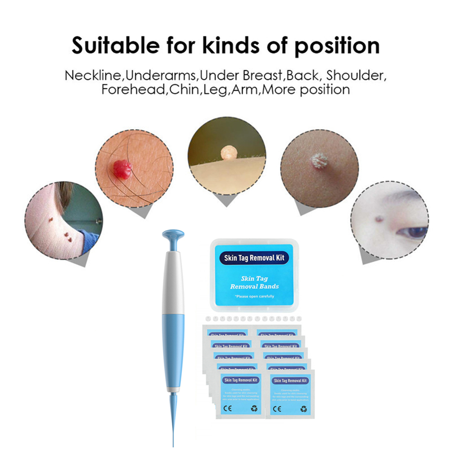 Non Toxic Face Care Mole Wart Tool For Small To Medium Blue Skin Tag Removal Kit With Cleansing Swabs Home Use Adult