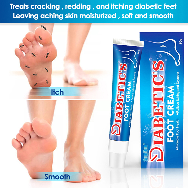 Diabetic Cream For Foot Care Herbal Ointment Relieve Toe Fungus Anti Fungal Infection Eczema Urticaria Beriberi Foot Care 20g