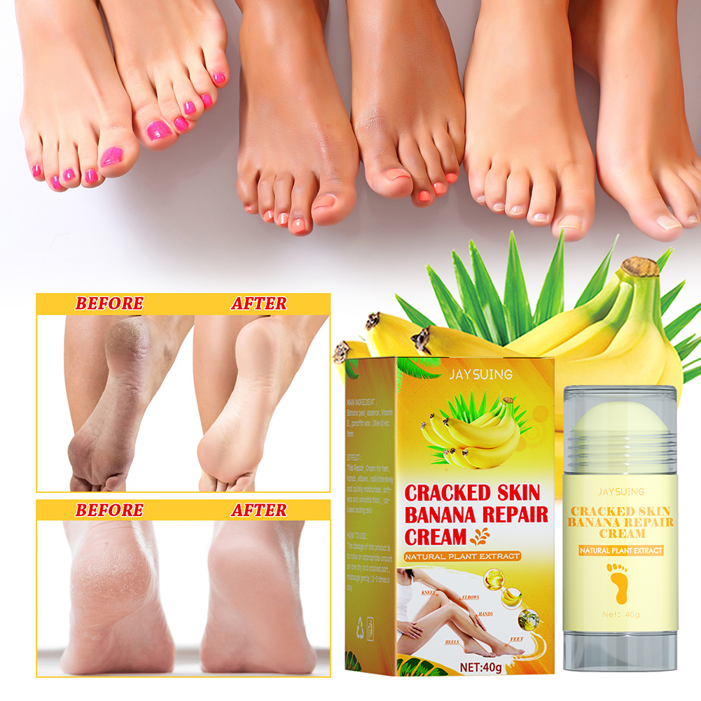 Foot Crack Cream Heel Chapped Peeling Repair Anti Dry Crack Remove Dead Skin Moisturizing Softens Feet Care Banana Oil Foot Care