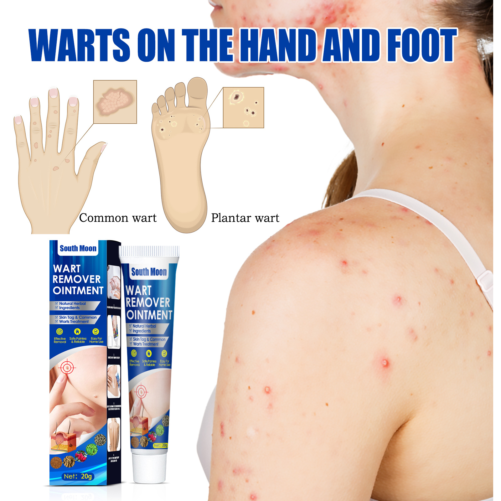 Wart relieving wart removing cream, wart removing cream hand foot face armpit meat particles