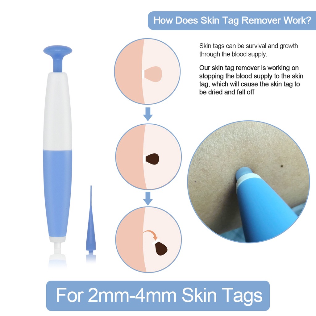 Skin Tag Remover Painless Mole Wart Remover Skin Tag Removal Kit with Cleansing Swabs Facial Beauty Tool