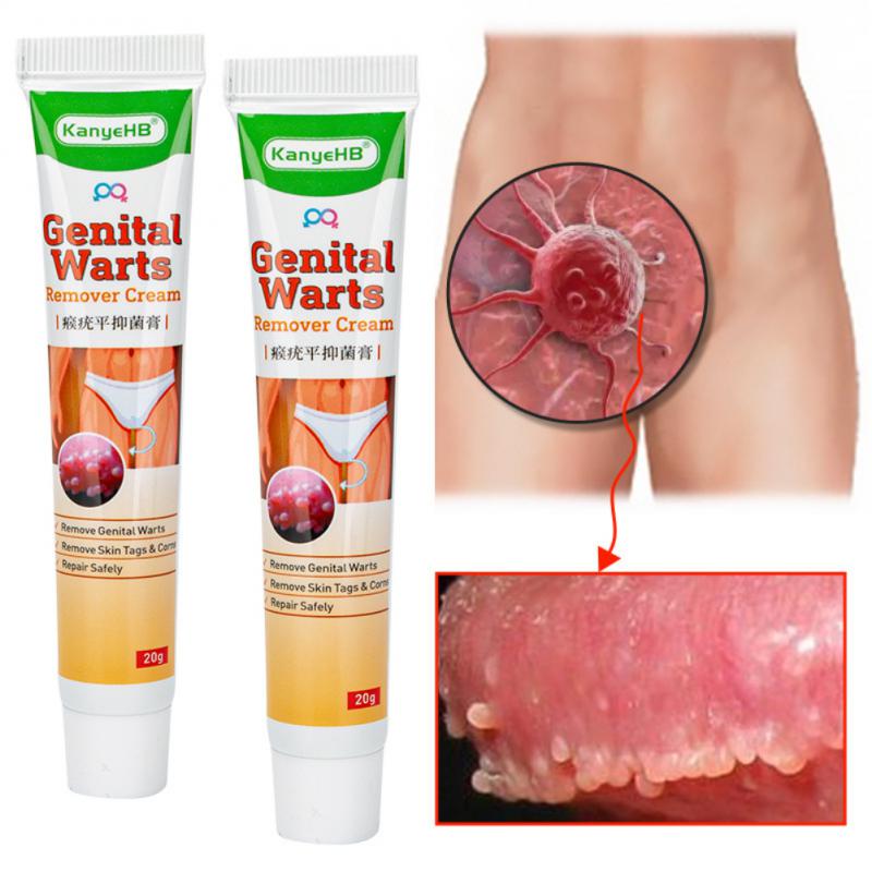 1pc Genital Wart Remover Ointment Vulva Herpes Condyloma Acuminatum Skin Tag Painless Remover Condyloma Treat Cream Papillomas