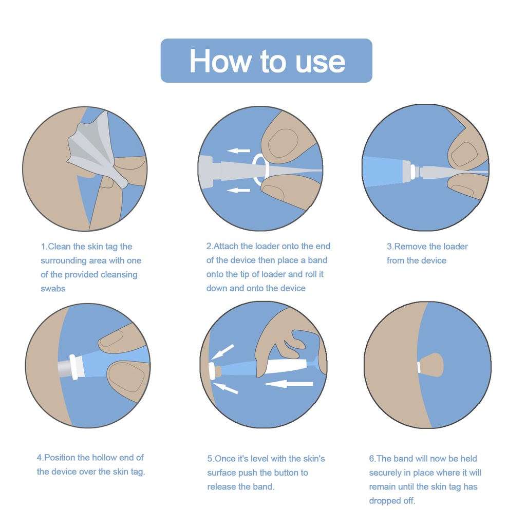 Skin Tag Remover Painless Mole Wart Remover Skin Tag Removal Kit with Cleansing Swabs Facial Beauty Tool