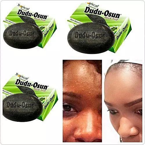 Dudu Osun Black Soap Tropical Natural Soap With Aloe Vera and Natural Vitamins Solution To Refreshed Healthy Skin Skin Care