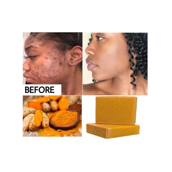 Natural Turmeric Soap Bar for Face & Body  Turmeric Skin Brightening Soap For Dark Spots Intimate Areas Underarms Turmeric Face Wash Reduces Acne, Fades Scars & Cleanses Skin – Turmeric Bar Soap