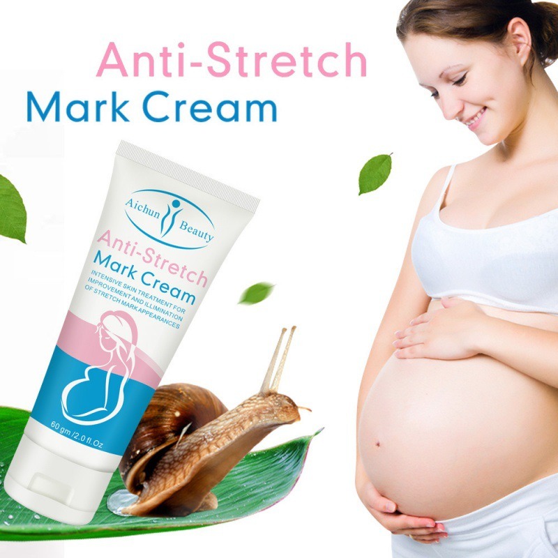 Best Price For Aichun Beauty Anti Stretch Mark Cream Intensive Firming