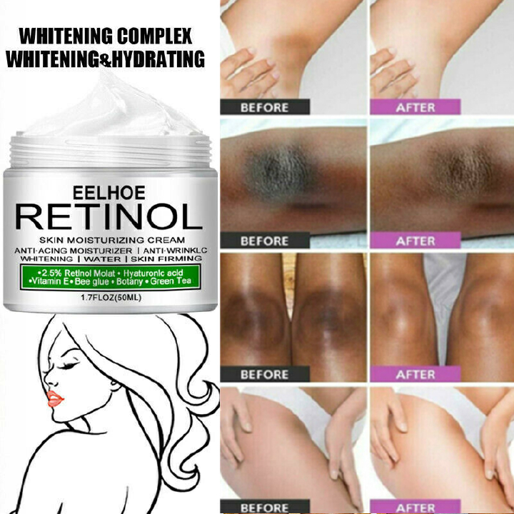 Body Whitening Cream Private Parts Underarm Bleaching Serum Whiten Butt Knee Brighten Inner Thigh Intimate Dark Remove Melanin Skin Care Fast delivery