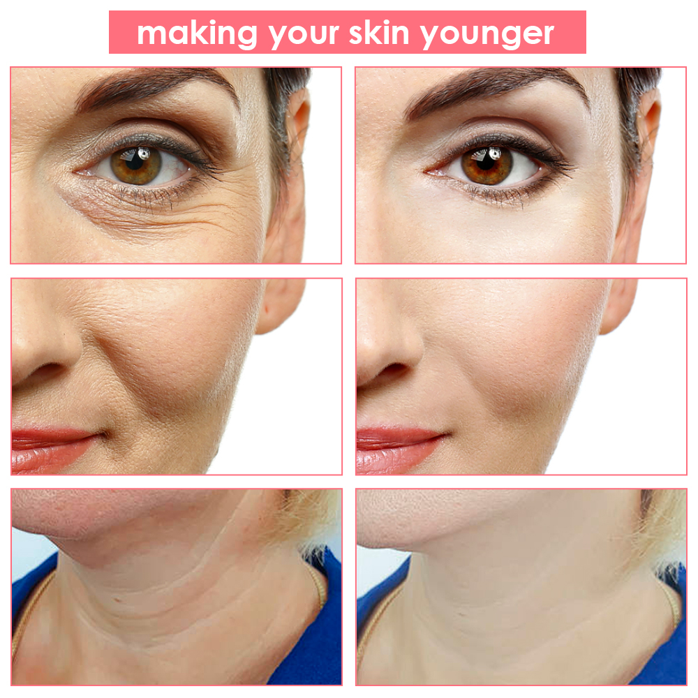 Beauty Device Microcurrent Radio Frequency Color Light Therapy IPL Skin Rejuvenation Face Lift Anti-aging Facial Massager