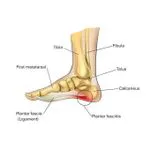 Fashion Arch Support Shoe Insoles Flat Plantar Fasciitis
