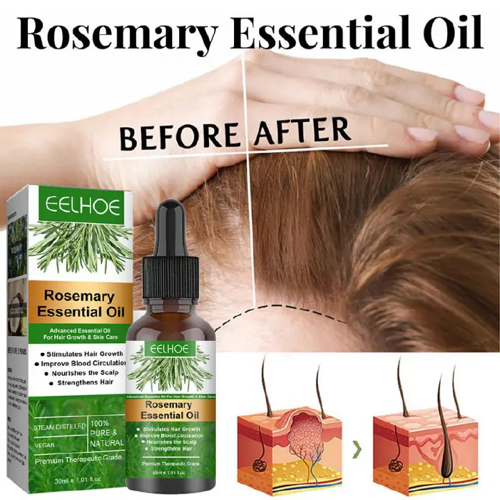 30mlFast Growing Anti Hair Loss Essential Oil Eelhoe Rosemary Hair Growth Oil Repair Damage Baldness Scalp Product Hairs Smooth Care