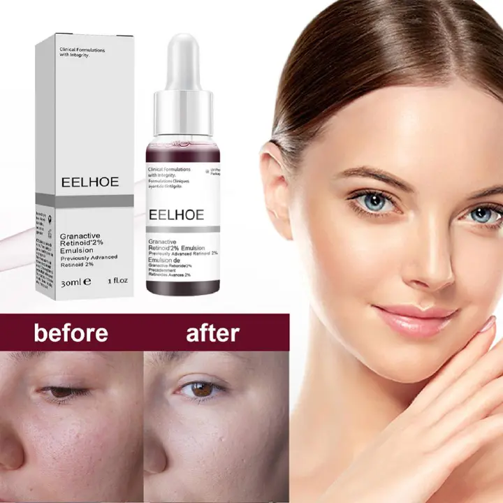 30ml Salicylic Acid Serum Shrink Pores Exfoliating Moisturizing Nourish Smooth Pores Repair Essences Skin Care Korean Cosmetic Fast delivery