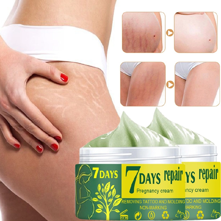 30g/50g Pregnancy  Repair  Cream Stretch Mark Removal Removal Acne Scar Stretch Marks Cream Fat Striae Gravidarum Treatment Body Creams Fast delivery