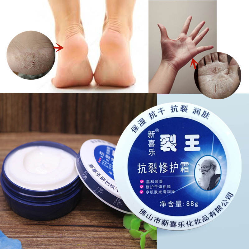 Anti-Crack Repair Cream 88g Moisturizing Anti-Dry Hand, Foot and Heel Crack King Cream Face Cream