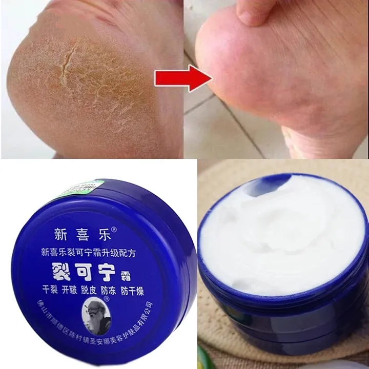 Anti-Crack Repair Cream 88g Moisturizing Anti-Dry Hand, Foot and Heel Crack King Cream Face Cream