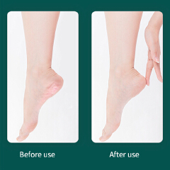 10Pcs Professional Pedicure Tools Set Foot Care Kit Stainless Steel Foot Rasp Foot Dead Skin Remover Callus Clean Feet Care